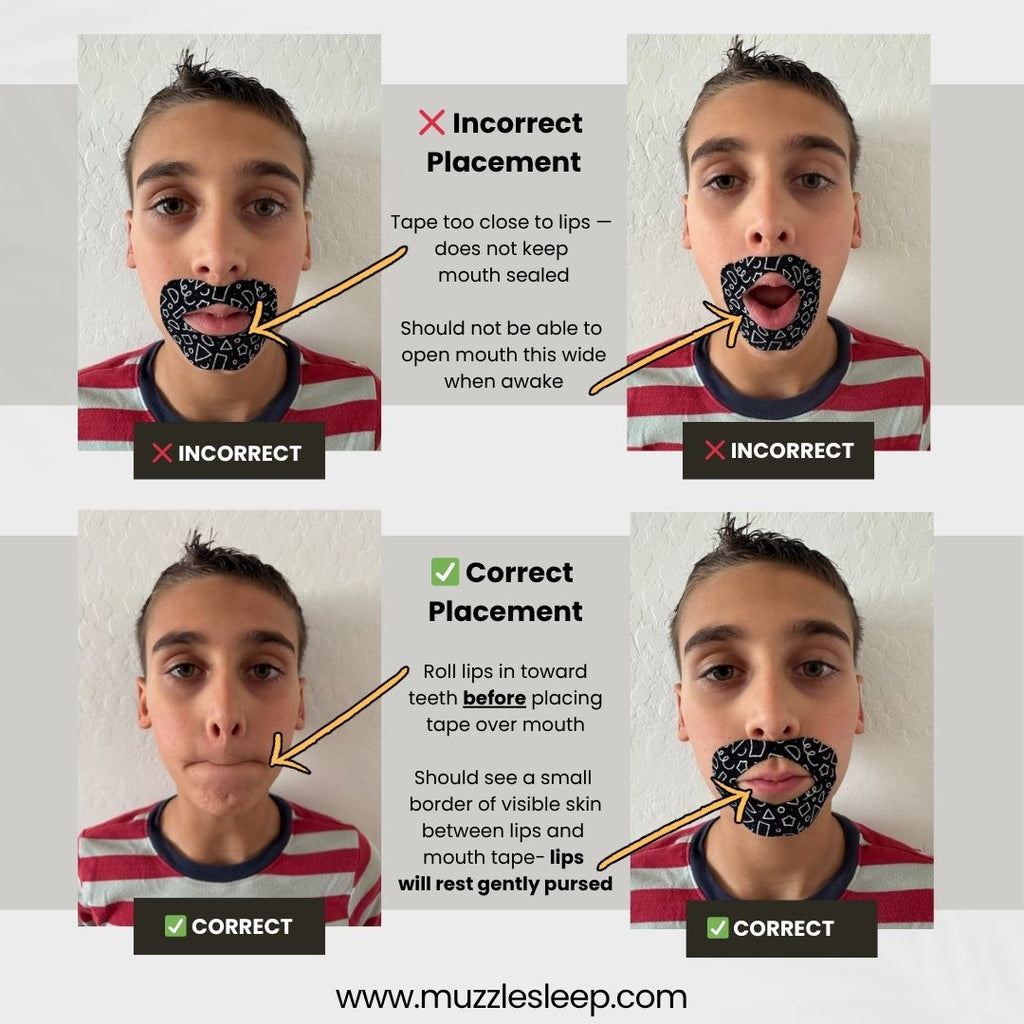 Muzzle® Mouth Tape For Kids (Medium Hold)